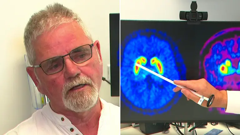 A simple daily pill could stop Parkinson's disease before it starts