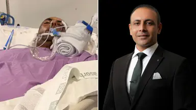 Real estate agent Ajay Malik faces long recovery after vicious dog attack in Brisbane